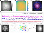 Efficient and Accurate Extraction of in Vivo Calcium Signals from Microendoscopic Video Data
